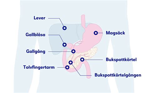 Bukspottkörtelcancer – Symtom & behandling – Cancer.se.
